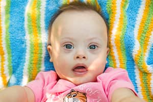 National Down Syndrome Society (NDSS)